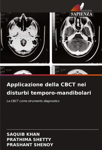 Applicazione della CBCT nei disturbi temporo-mandibolari