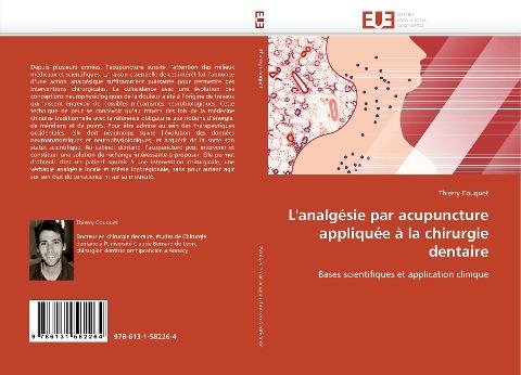 L'analgésie par acupuncture appliquée à la chirurgie dentaire