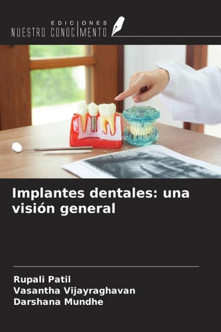 Implantes dentales: una visión general